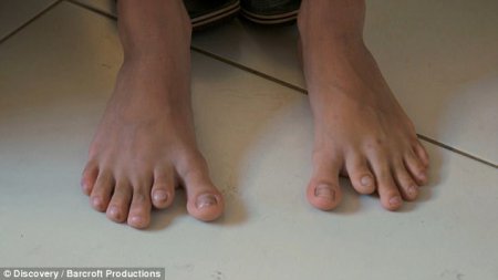 В Бразилии проживает семья, 14 членов которой имеют по 12 пальцев на руках и на ногах (фото, видео)