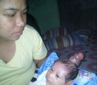На Филиппинах родился "мальчик-единорог" (фото, видео)