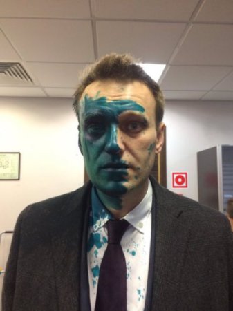 Навального облили зеленкой в Москве (фото)