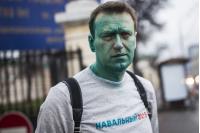 Навального прооперировали в Барселоне, зрение восстановится не сразу