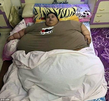 Египтянка за два с половиной месяца похудела на 325 килограммов! (фото)