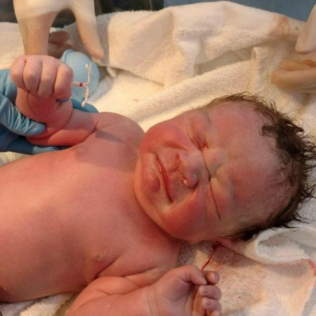В США ребенок родился с контрацептивом в руках (фото)