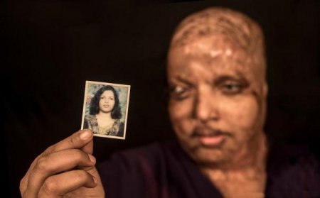 Индианка, которую изуродовали кислотой десять лет назад, нашла свою любовь и выходит замуж (фото)