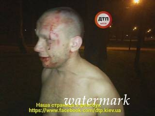 В Киеве опьяненный атошник во время драки бросил под ноги людям гранату